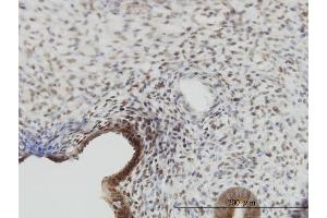 Immunoperoxidase of monoclonal antibody to YAP1 on formalin-fixed paraffin-embedded human endometrium.