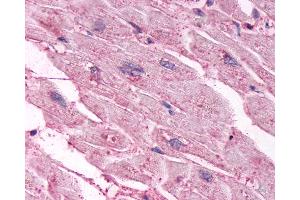 Anti-CHRM3 / M3 antibody IHC of human heart.