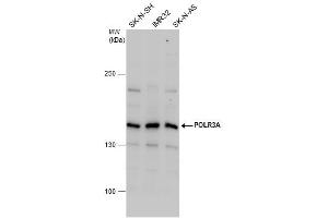 WB Image POLR3A antibody detects POLR3A protein by western blot analysis. (POLR3A anticorps  (N-Term))