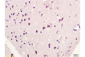 Formalin-fixed and paraffin embedded rat brain labeled with Rabbit Anti-HSP27/HspB1/HSP25 Polyclonal Antibody, Unconjugated  at 1:200 followed by conjugation to the secondary antibody and DAB staining.