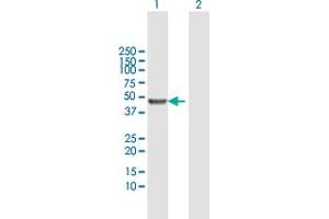 Western Blot analysis of KRT20 expression in transfected 293T cell line by KRT20 MaxPab polyclonal antibody.