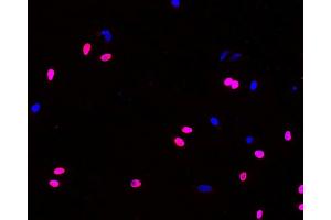 Immunofluorescence analysis of Hela cells(treated with 0. (BrdU anticorps)