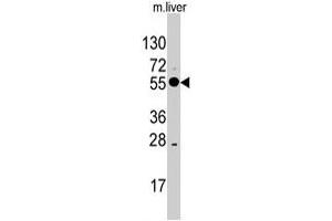Western blot analysis of ALDH8A1 polyclonal antibody  in mouse liver tissue lysates (35 ug/lane). (ALDH8A1 anticorps  (C-Term))