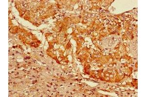 Immunohistochemistry of paraffin-embedded human adrenal gland tissue using ABIN7153725 at dilution of 1:100 (GFRA3 anticorps  (AA 32-236))
