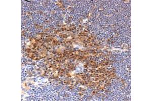 Immunohistochemical staining in mouse thymus with PFN1 polyclonal antibody . (PFN1 anticorps  (AA 100-140))
