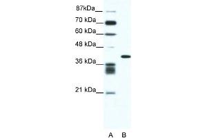 WB Suggested Anti-ALX4 Antibody Titration: 0. (ALX4 anticorps  (N-Term))