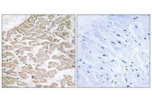 Immunohistochemistry (IHC) image for anti-Ras-Related Associated with Diabetes (RRAD) (Internal Region) antibody (ABIN1851412) (RRAD anticorps  (Internal Region))