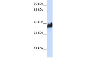 CLN8 antibody used at 1 ug/ml to detect target protein. (CLN8 anticorps)