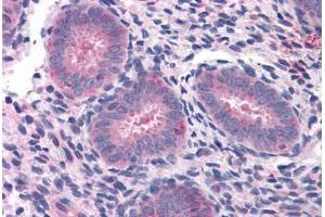 Human Uterus: Formalin-Fixed, Paraffin-Embedded (FFPE) (ELP3/KAT9 anticorps  (AA 240-445))