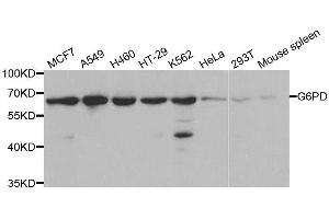 Western blot analysis of extracts of various cell lines, using G6PD antibody. (Glucose-6-Phosphate Dehydrogenase anticorps  (AA 246-545))