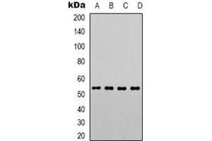Western blot analysis of PTEN (pS380/T382/T383) expression in Hela (A), A431 (B), MCF7 (C), RAW264. (PTEN anticorps  (C-Term, pSer380, pThr382, pThr383))