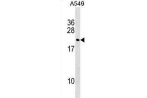 Western Blotting (WB) image for anti-Double Homeobox 3 (DUX3) antibody (ABIN2999836)