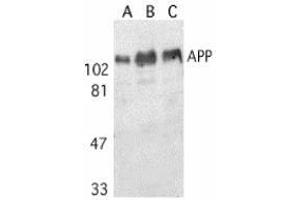 Western blot analysis of APP in human (A), mouse (B), and rat (C) brain tissue lysates with AP30070PU-N APP antibody at 1 μg/ml. (APP anticorps)
