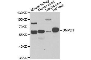 Western blot analysis of extracts of various cell lines, using SMPD1 antibody. (SMPD1 anticorps  (AA 70-340))