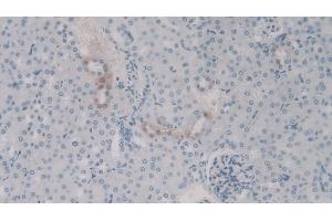 Detection of C4a in Mouse Kidney Tissue using Polyclonal Antibody to Complement Component 4a (C4a)