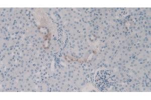 Detection of C4a in Mouse Kidney Tissue using Polyclonal Antibody to Complement Component 4a (C4a) (C4A anticorps)