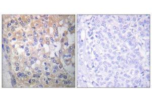 Immunohistochemistry (IHC) image for anti-FYN Oncogene Related To SRC, FGR, YES (FYN) (pTyr530) antibody (ABIN1847258) (FYN anticorps  (pTyr530))
