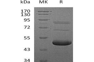 Western Blotting (WB) image for Ephrin A5 (EFNA5) (Active) protein (His tag) (ABIN7320515)