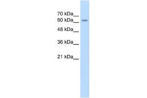 WB Suggested Anti-SARDH Antibody Titration: 2. (SARDH anticorps  (Middle Region))