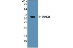Detection of Recombinant CTSK, Human using Polyclonal Antibody to Cathepsin K (CTSK)
