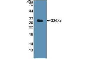 Detection of Recombinant CTSK, Human using Polyclonal Antibody to Cathepsin K (CTSK) (Cathepsin K anticorps  (AA 54-317))