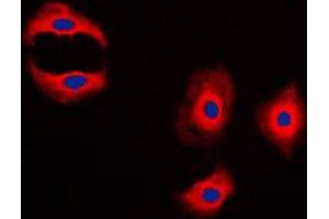 Immunofluorescent analysis of MMP3 staining in A431 cells. (MMP3 anticorps  (C-Term))