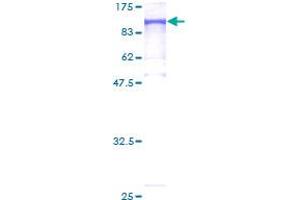 Image no. 1 for MutL Homolog 1 (MLH1) (AA 1-756) protein (GST tag) (ABIN1311004) (MLH1 Protein (AA 1-756) (GST tag))