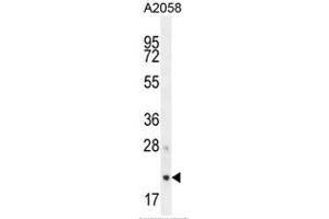 AP3S1 anticorps  (N-Term)