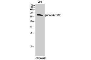 Western Blotting (WB) image for anti-P21-Activated Kinase 1 (PAK1) (pThr212) antibody (ABIN3182552) (PAK1 anticorps  (pThr212))