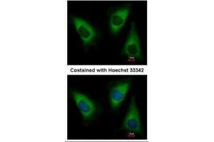 anti-Lysyl-tRNA Synthetase (KARS) antibody