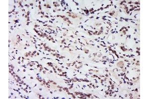 Formalin-fixed and paraffin embedded human kidney labeled with Rabbit Anti-HS1BP3 Polyclonal Antibody, Unconjugated  at 1:200 followed by conjugation to the secondary antibody and DAB staining.