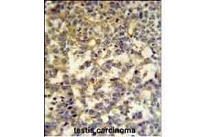 G6PD Antibody (Center) (ABIN651286 and ABIN2840171) IHC analysis in formalin fixed and paraffin embedded testis followed by peroxidase conjugation of the secondary antibody and DAB staining.
