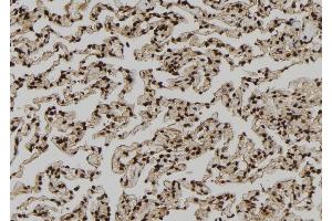 ABIN6264086 and ABIN6279212 at 1/100 staining Human lung tissue by IHC-P. (PDE1A anticorps  (Internal Region))