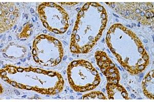 Immunohistochemistry of paraffin-embedded Human kidney using OLR1 Polyclonal Antibody at dilution of 1:200 (40x lens). (OLR1 anticorps)