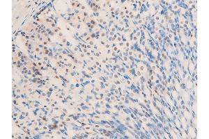 ABIN6267283 at 1/100 staining mouse gastric tissue sections by IHC-P. (ErbB2/Her2 anticorps  (pTyr1248))