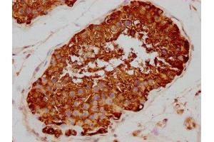 IHC image of ABIN7127552 diluted at 1:80 and staining in paraffin-embedded human testis tissue performed on a Leica BondTM system.