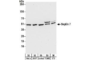 Western Blotting (WB) image for anti-Septin 7 (SEPT7) (AA 75-125) antibody (ABIN7450722)