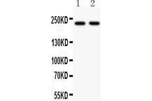 Anti- NMDAR2B Picoband antibody, Western blotting All lanes: Anti NMDAR2B  at 0.