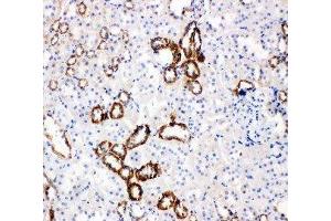 Anti-Glucose Transporter 5 GLUT5 antibody, IHC(P) IHC(P): Rat Kidney Tissue (SLC2A5 anticorps  (Middle Region))