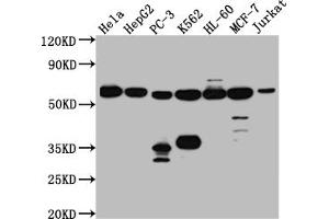 Western Blot Positive WB detected in: Hela whole cell lysate, HepG2 whole cell lysate, PC-3 whole cell lysate, K562 whole cell lysate, HL-60 whole cell lysate, MCF-7 whole cell lysate, Jurkat whole cell lysate All lanes: PTBP1 antibody at 1:1000 Secondary Goat polyclonal to rabbit IgG at 1/50000 dilution Predicted band size: 58, 60, 60 kDa Observed band size: 58 kDa (Recombinant PTBP1 anticorps)