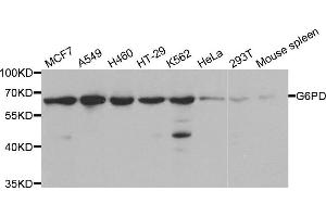 Western blot analysis of extracts of various cell lines, using G6PD antibody. (Glucose-6-Phosphate Dehydrogenase anticorps)