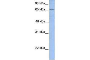 Human MCF-7; WB Suggested Anti-ACSL1 Antibody Titration: 0. (ACSL1 anticorps  (N-Term))