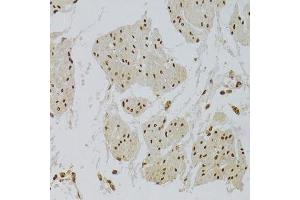 Immunohistochemistry of paraffin-embedded human stomach using XRCC6 Antibody.