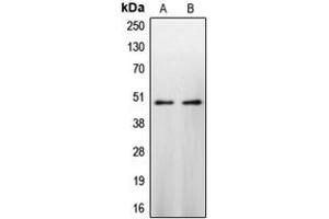 Western blot analysis of Caspase 9 expression in HeLa (A), NIH3T3 (B) whole cell lysates. (Caspase 9 anticorps  (Center))