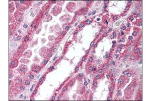 Image no. 1 for anti-Interleukin-1 Receptor-Associated Kinase 4 (IRAK4) (AA 120-136), (AA 38-54) antibody (ABIN372431)