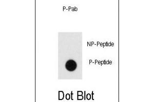 Dot Blot (DB) image for anti-Endophilin (pTyr80) antibody (ABIN3001911) (Endophilin (pTyr80) anticorps)