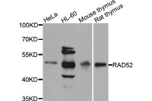 Western blot analysis of extracts of various cell lines, using RAD52 antibody (ABIN5971575) at 1/1000 dilution. (RAD52 anticorps)
