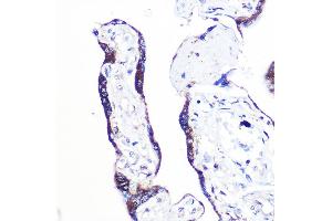 Immunohistochemistry of paraffin-embedded human placenta using PEX2 Rabbit pAb (ABIN7269248) at dilution of 1:100 (40x lens). (PEX2 anticorps  (AA 1-130))