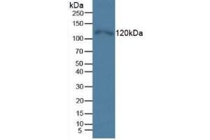 Western blot analysis of Human HeLa cells. (TLR5 anticorps  (AA 693-858))