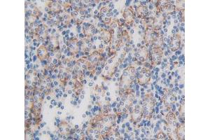 Figure. (LPHN3 anticorps  (AA 1105-1447))